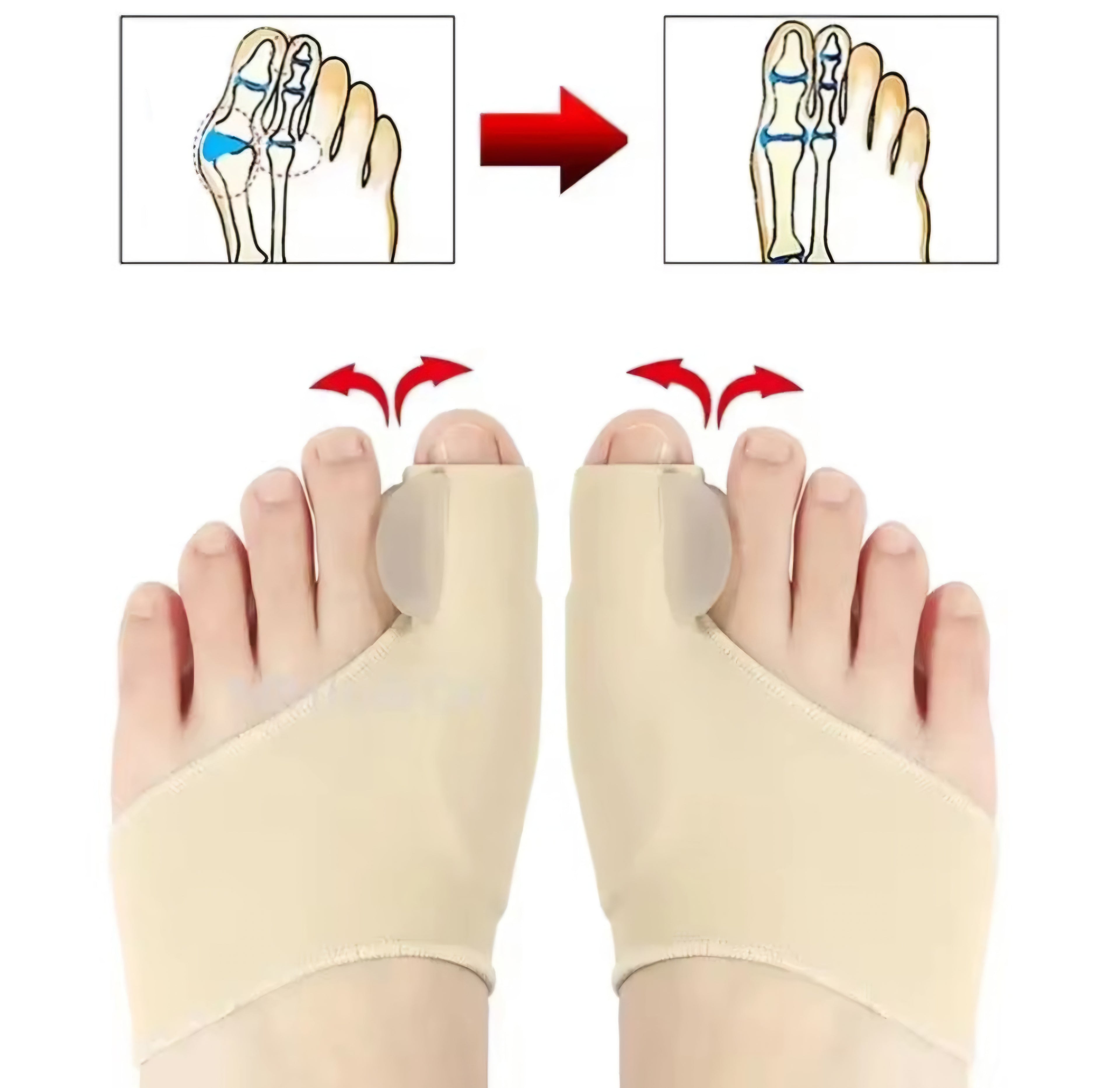ToeAlign™ Orthopedic Night Splint